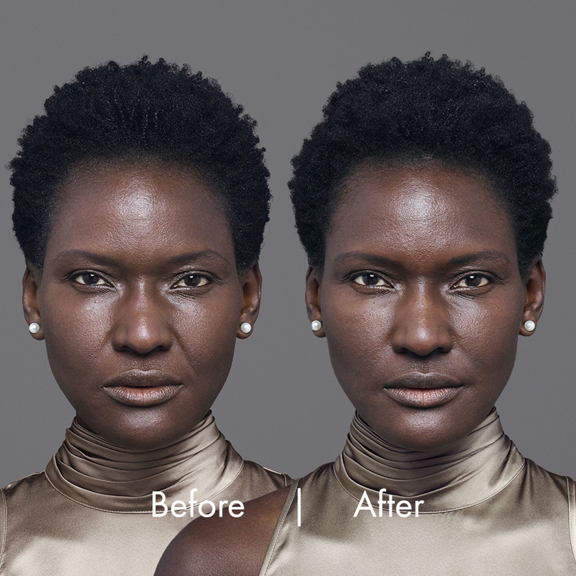 Amiende before and after pictures