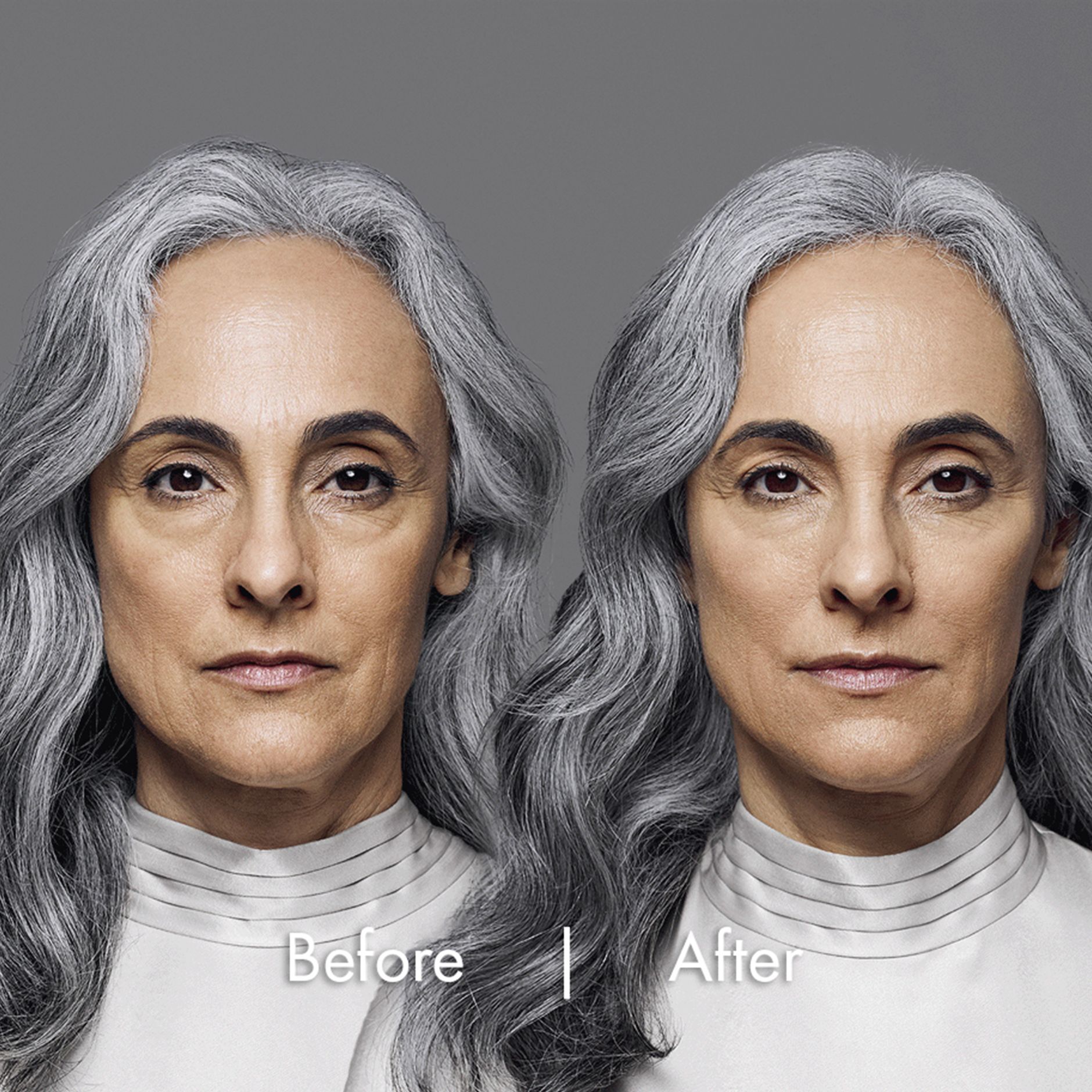 Claudine before and after pictures