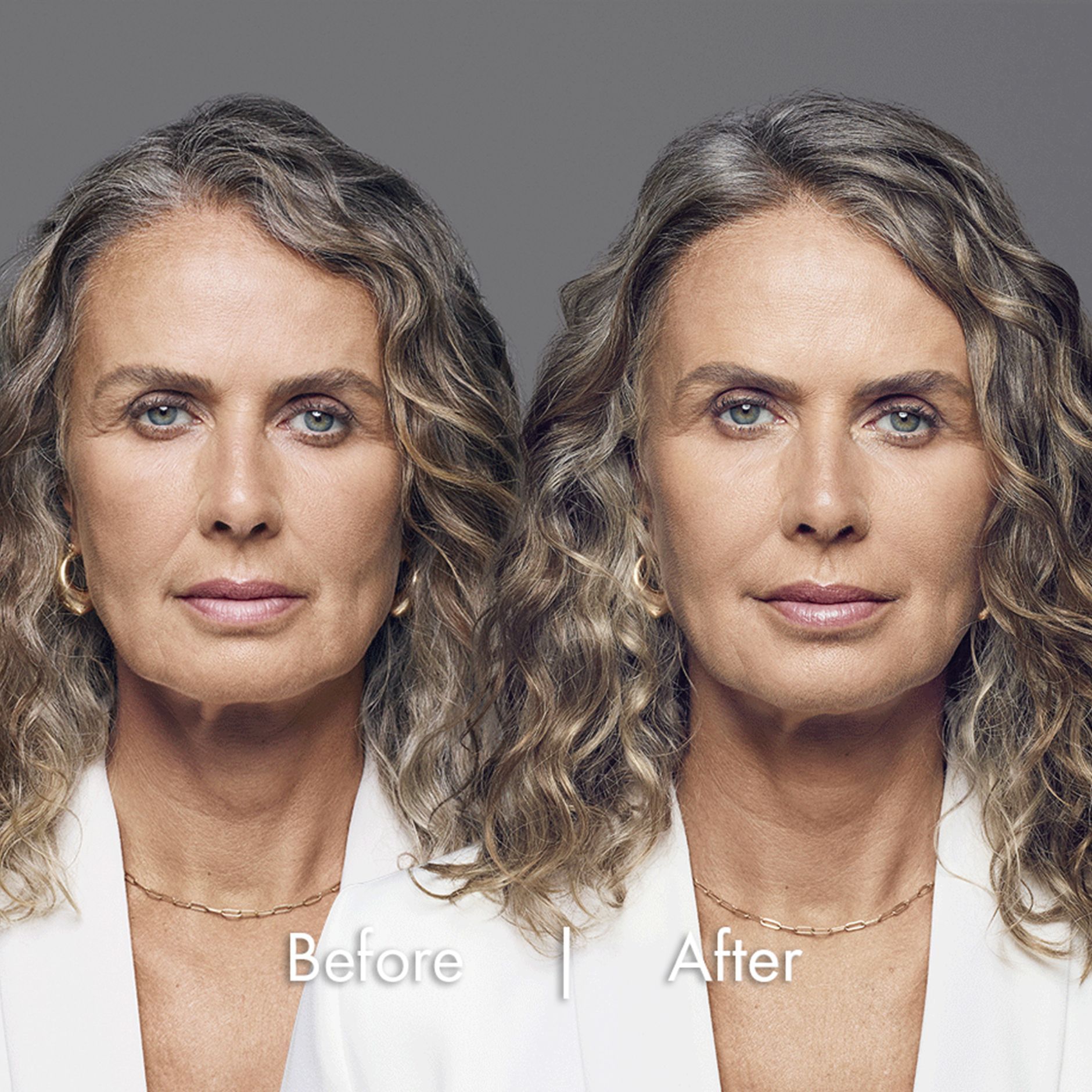 Laura before & after pictures