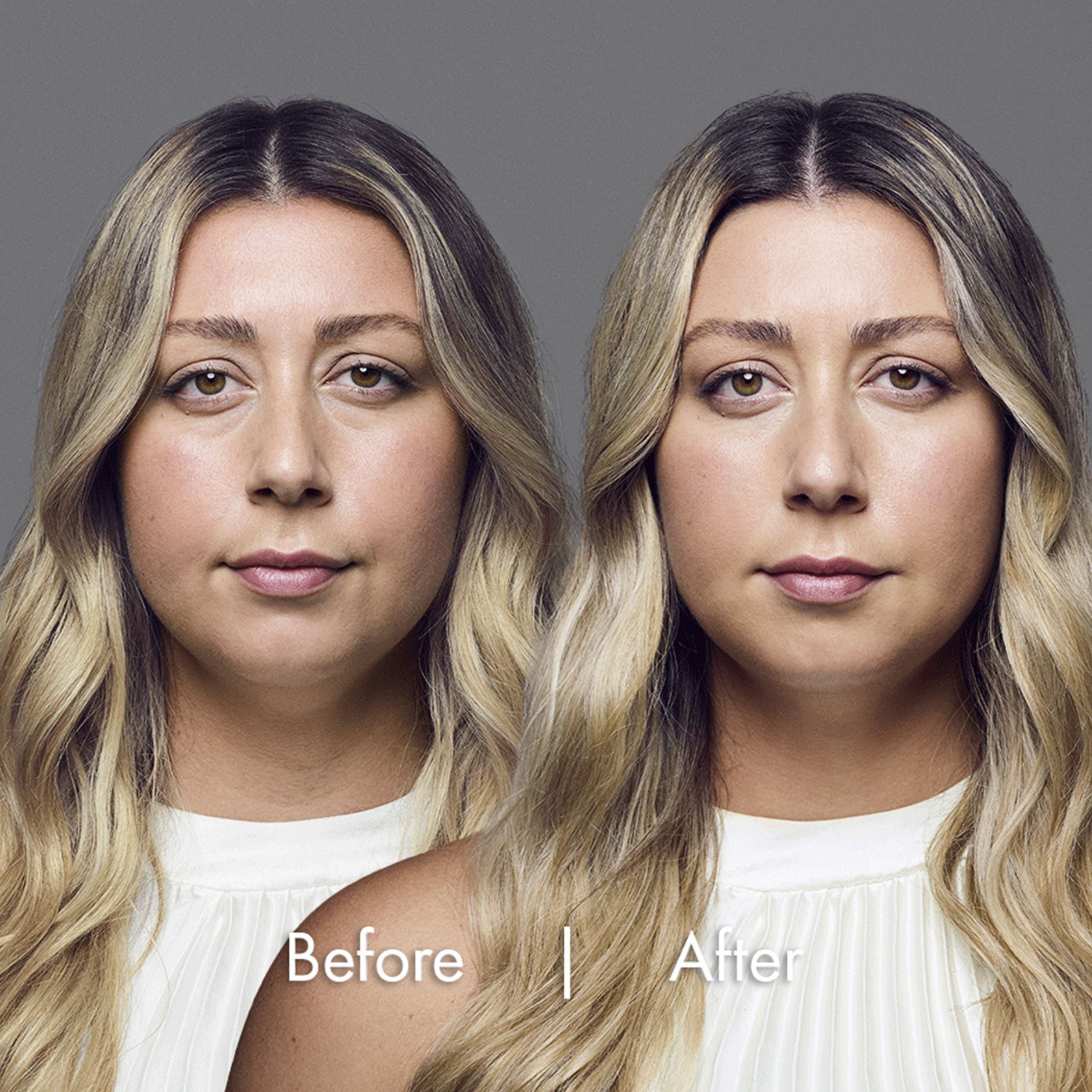 Lexi before and after pictures