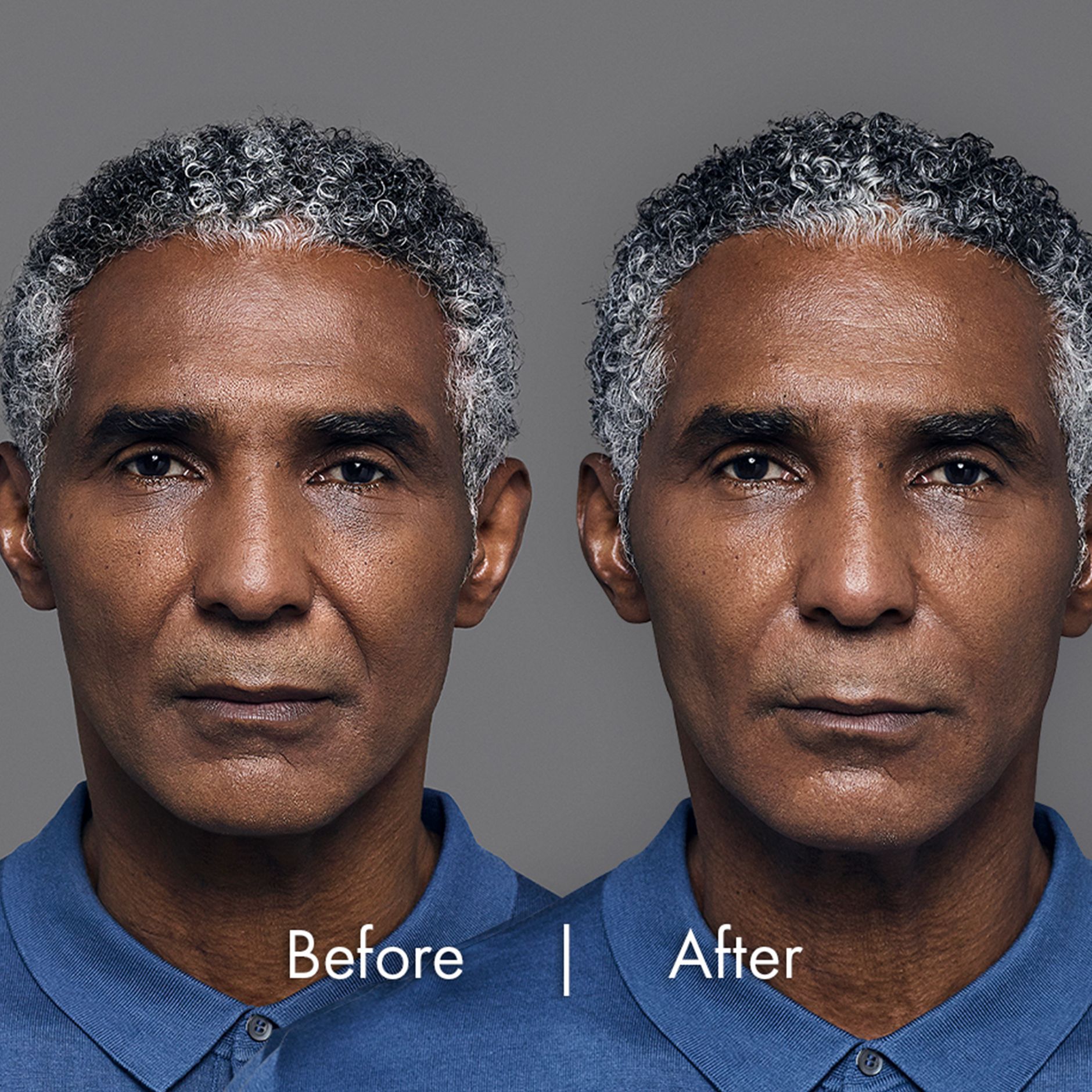 Andray before and after pictures