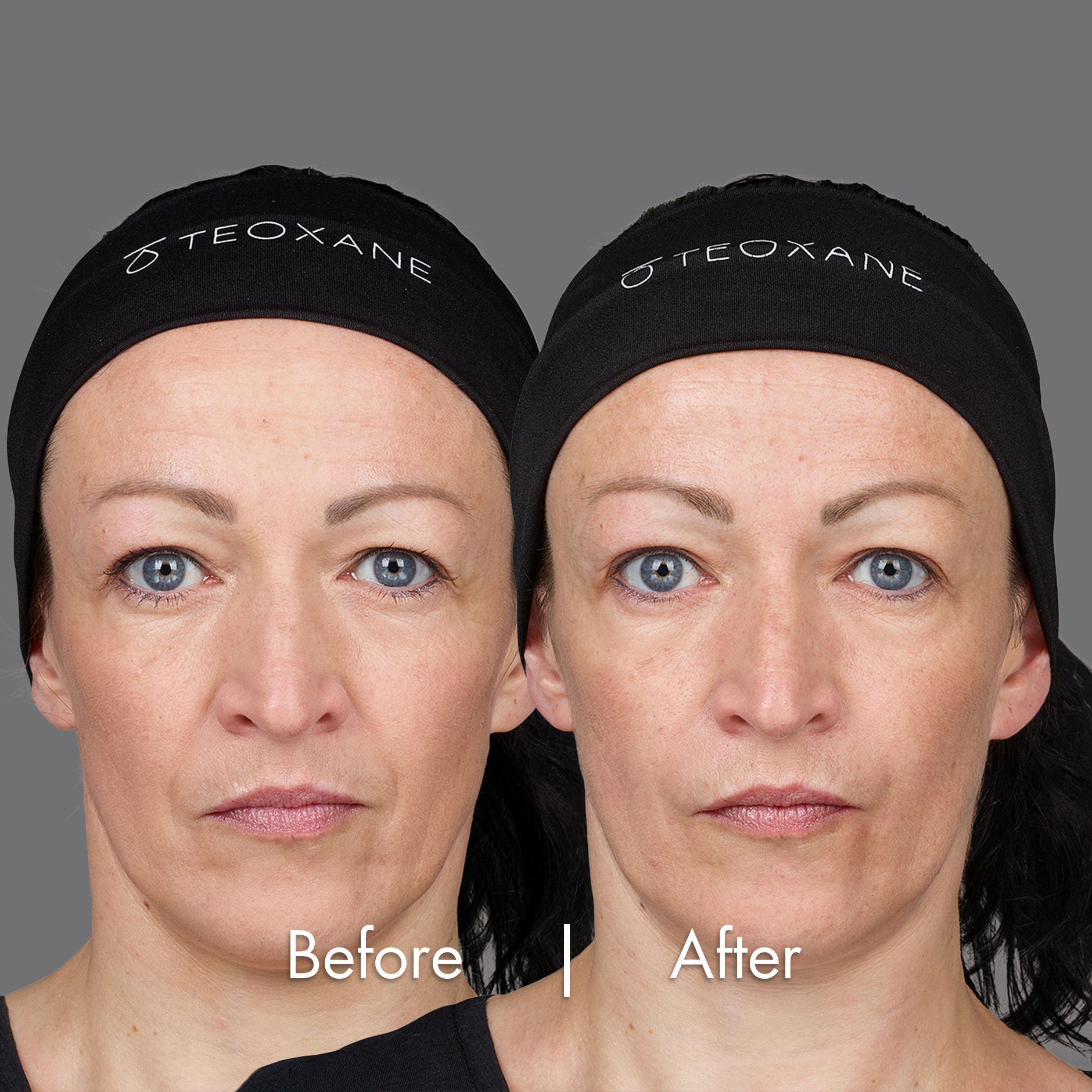 Laetitia's Before and After