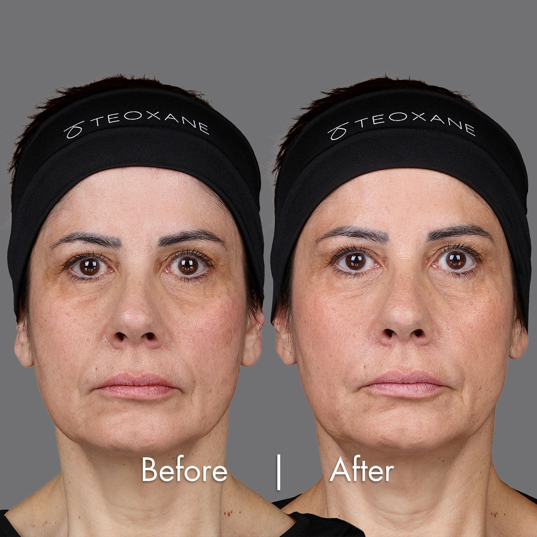 Sarah's Before and After