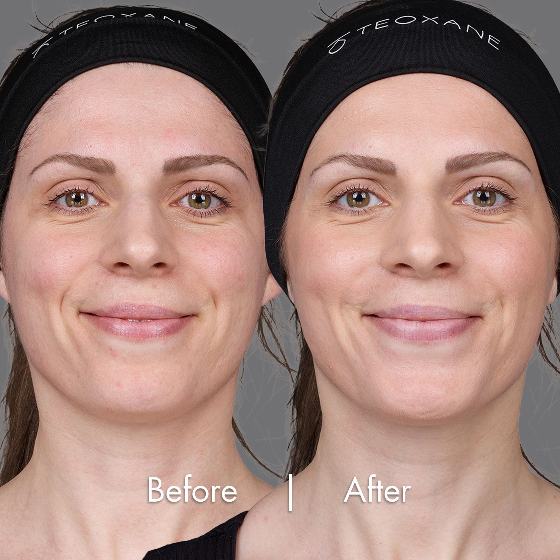 Valdette's Before and After