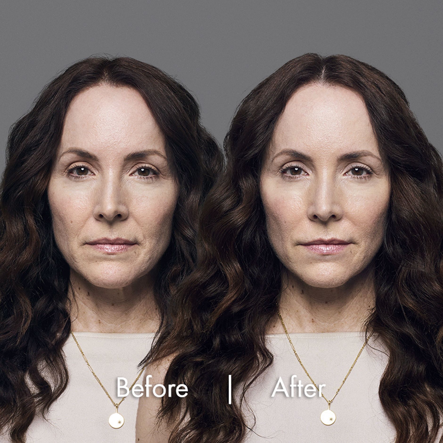 Elizabeth before and after pictures